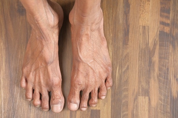 Foot Care For Seniors