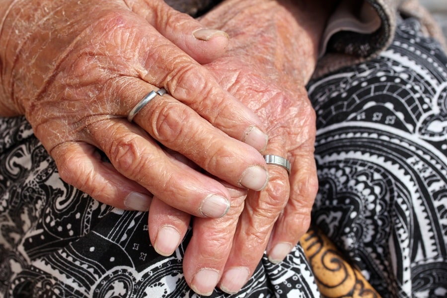 Ridges In Fingernails