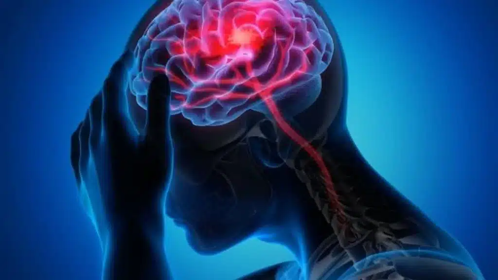 Don't Ignore These Warning Signs of a Stroke